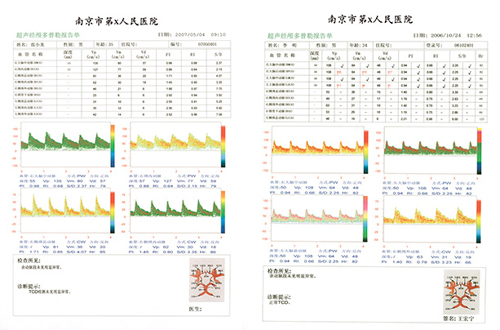 TCD檢測報告